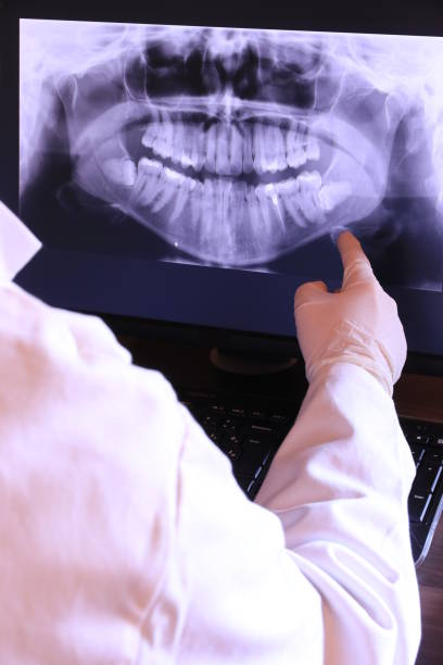 Best Emergency Denture Repair in Sparta, GA