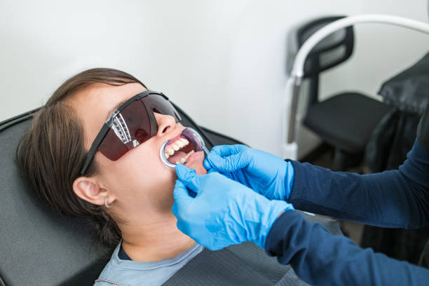 Best Knocked-Out Tooth (Avulsed Tooth) Treatment in Sparta, GA